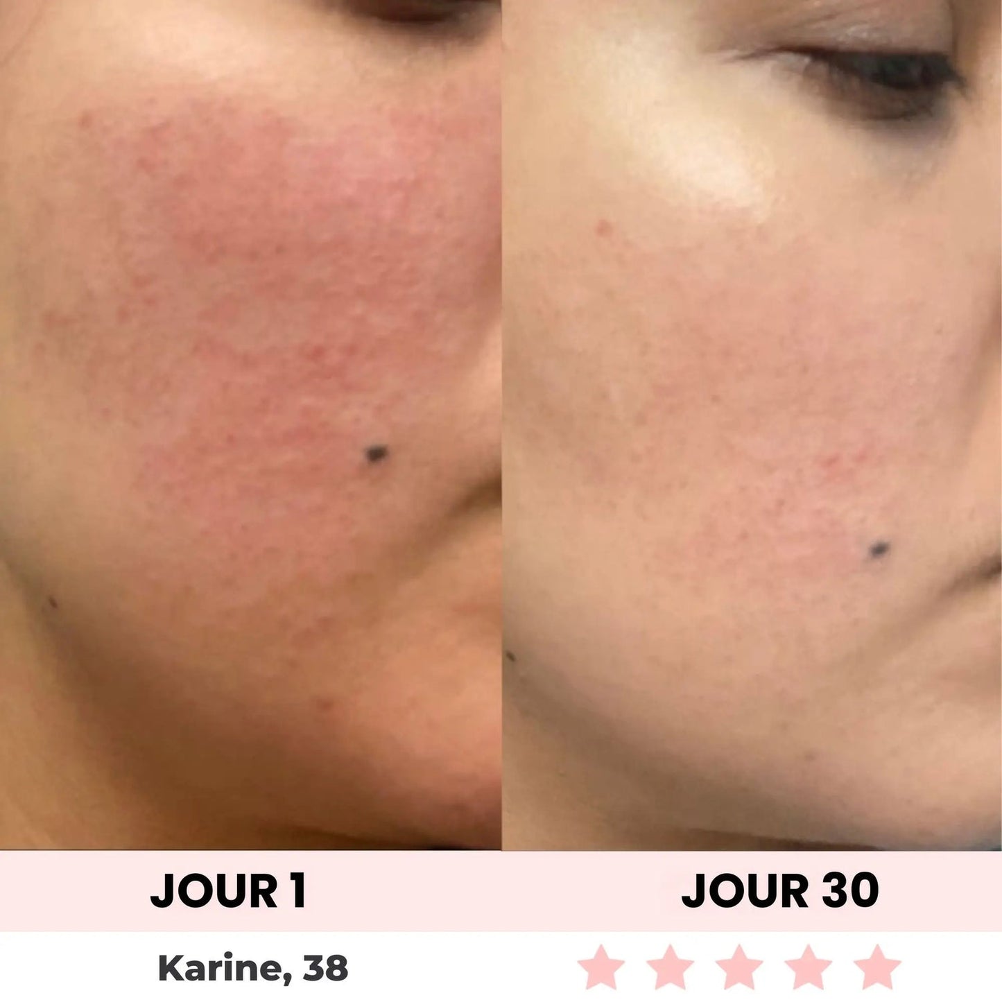 Sculpteur facial Led 7 en 1.