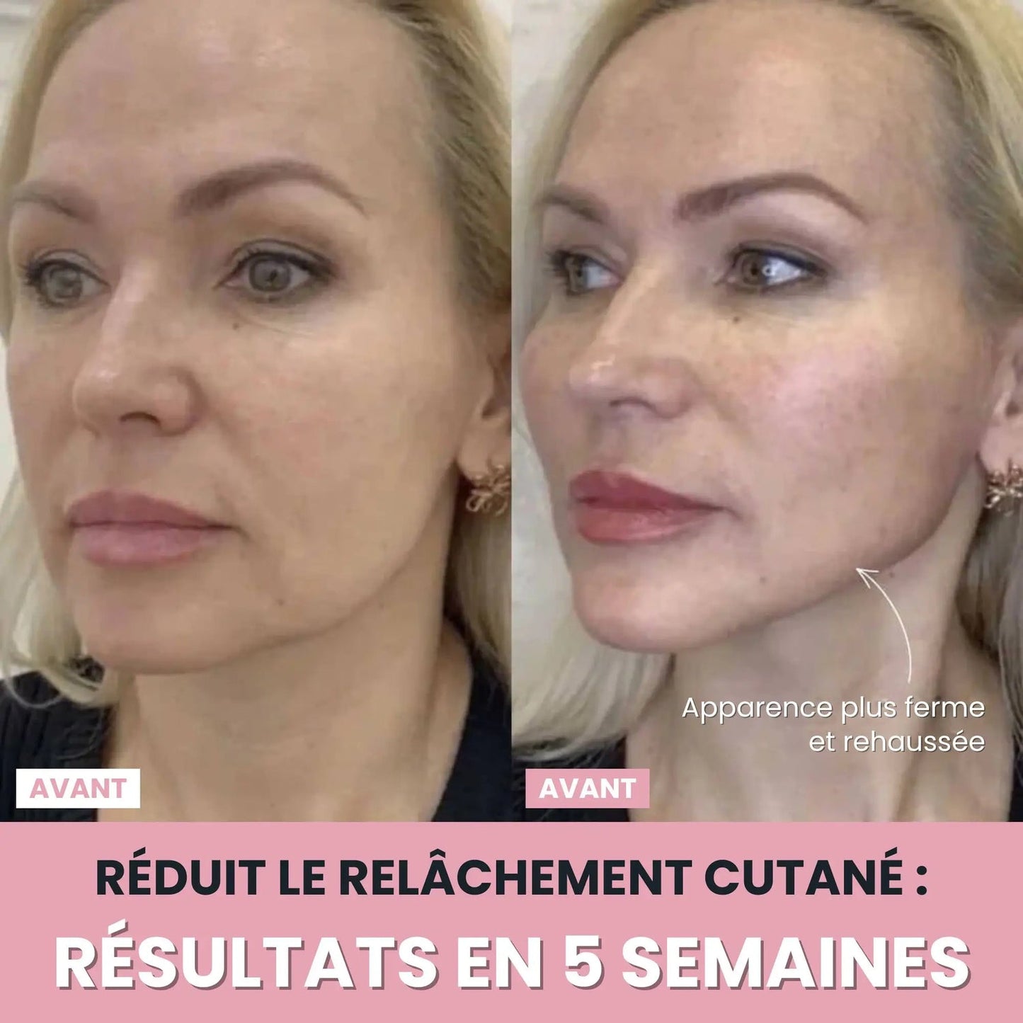 Sculpteur facial Led 7 en 1.
