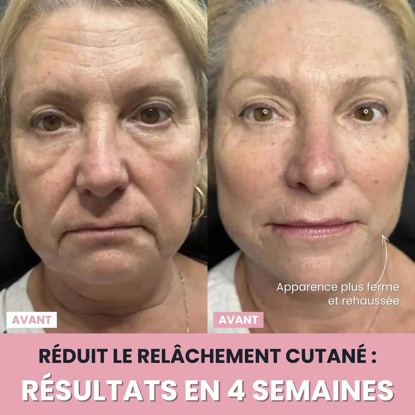 Sculpteur facial Led 7 en 1.