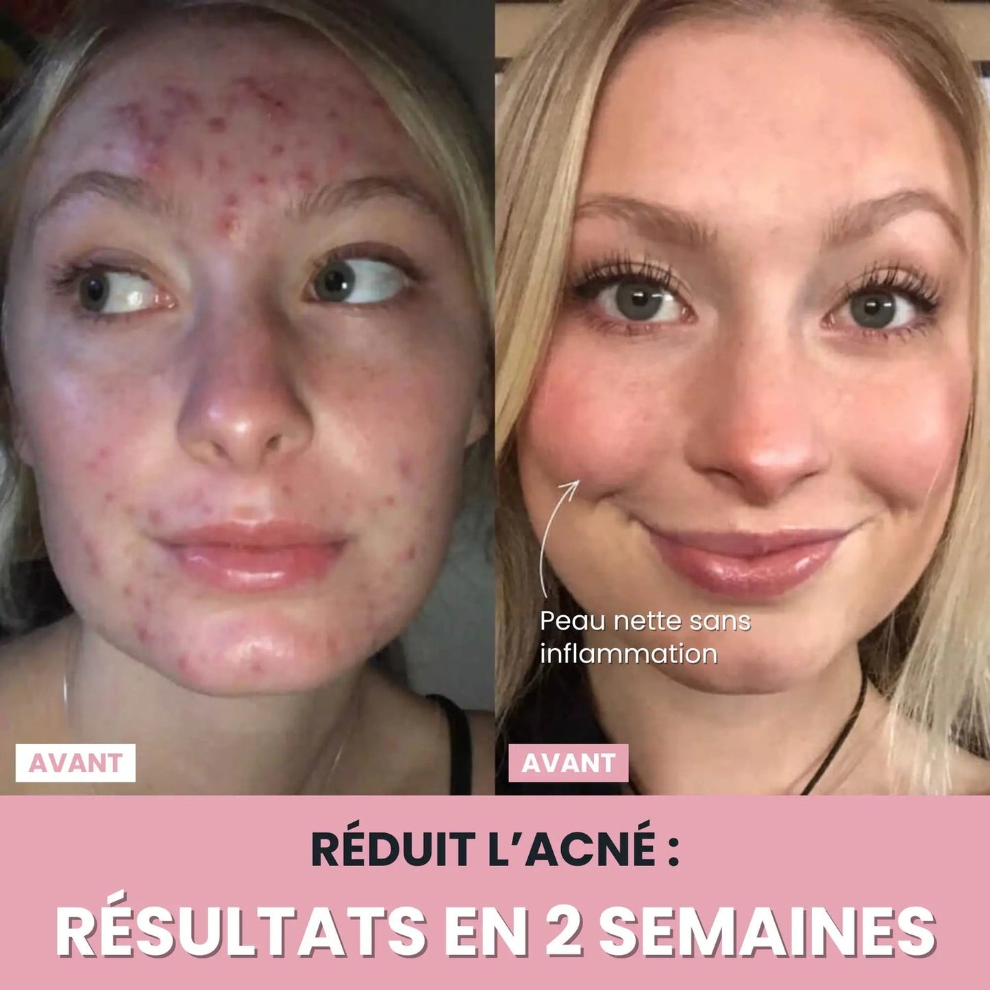 Sculpteur facial Led 7 en 1.