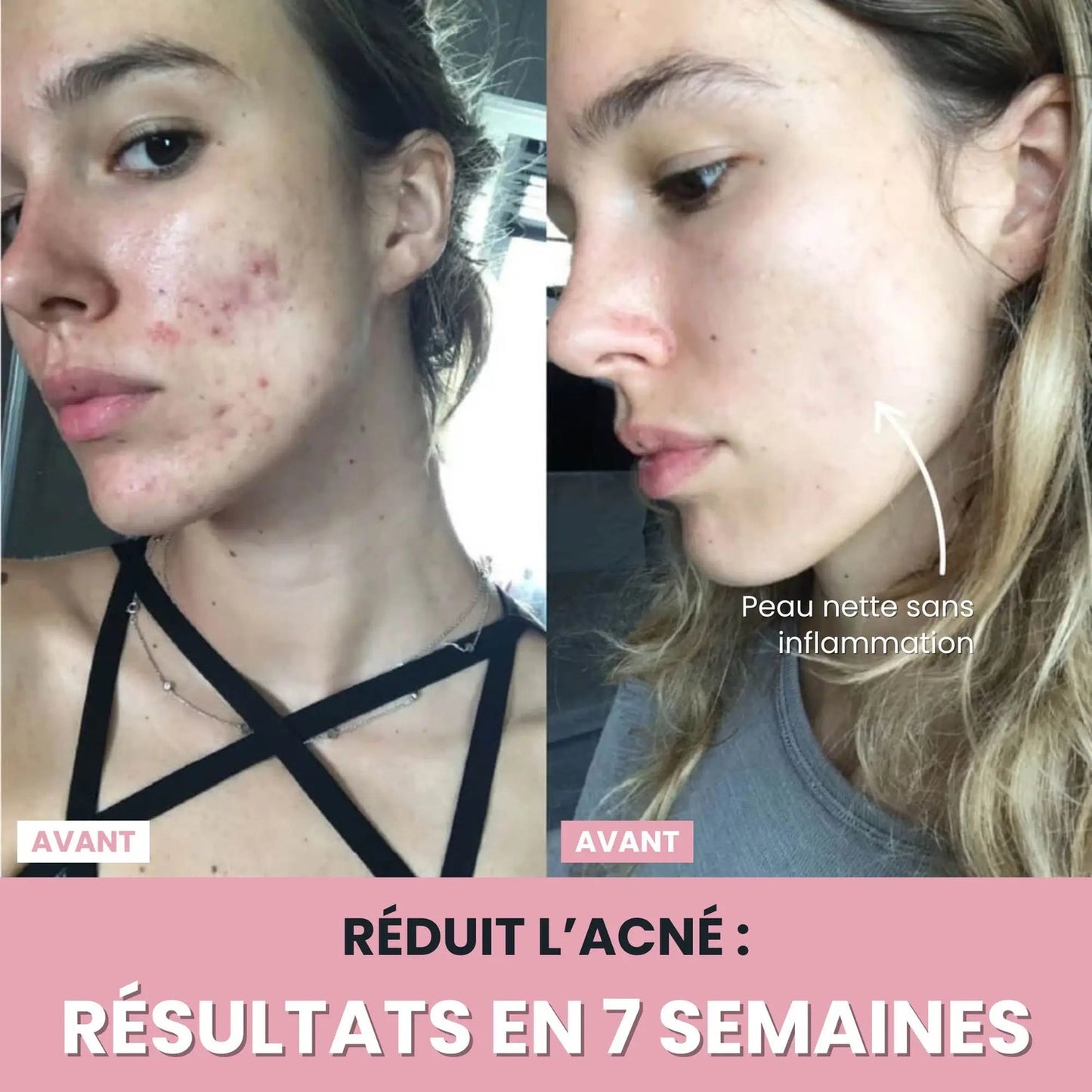 Sculpteur facial Led 7 en 1.