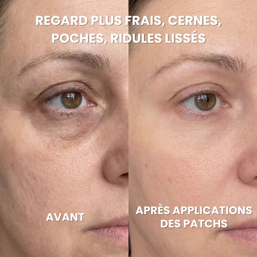 Patchs Hydrogel Anti-Cernes