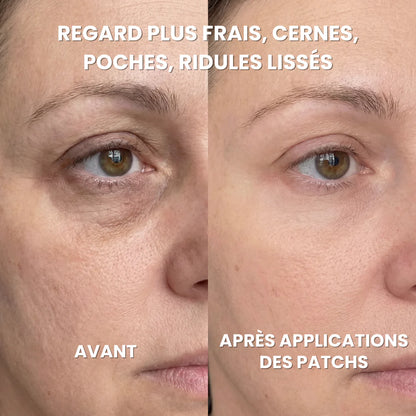 Patchs Hydrogel Anti-Cernes