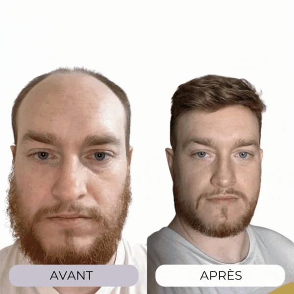 TECHNOLOGIE CAPILLAIRE MICRO-INFUSE® – HOMME